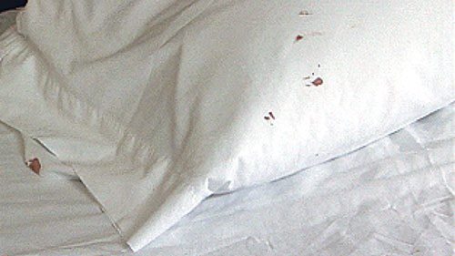 How Do You Know if You Have Bed Bugs