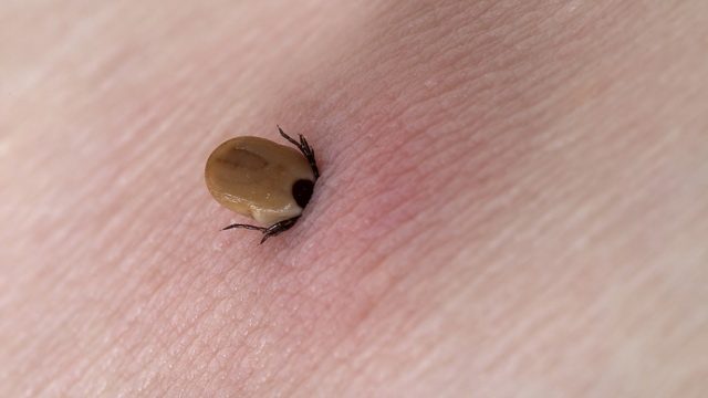 what is the best way to remove a tick